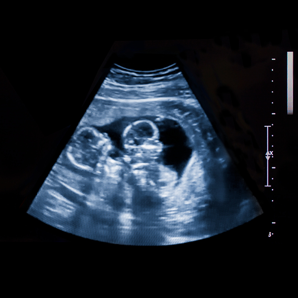 Beyond_MultiplesPrenatal_600x6004