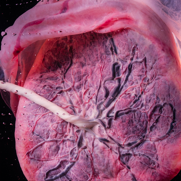 Beyond_Placenta_600x6003